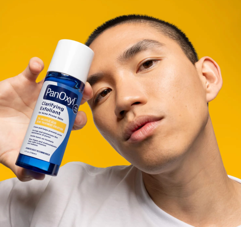 5 Mistakes to Avoid When Using the Best Acne Treatment